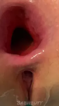 Huge Anal Gaping #anal