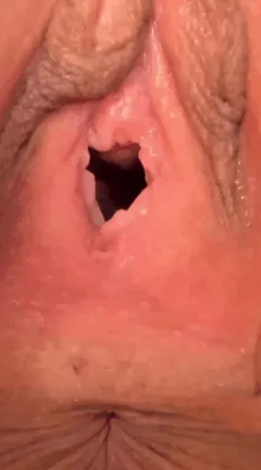little gape