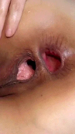 gaped wink